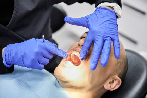 Best Broken or Chipped Tooth Repair in Cresaptown, MD