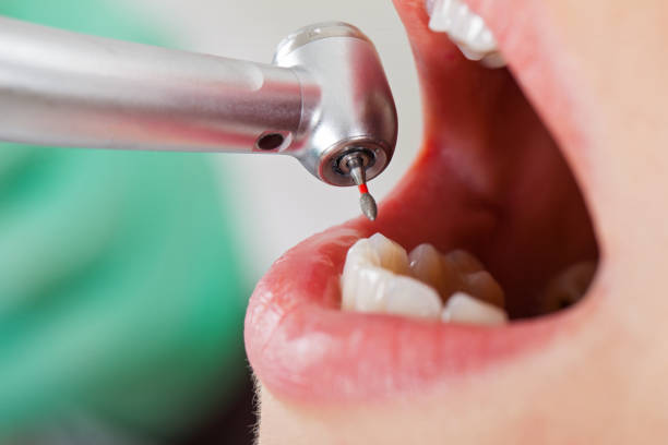 Best After-Hours Dental Care in Cresaptown, MD